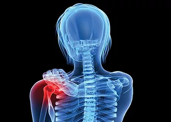 Bonehealth 1