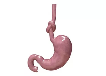 Digestion 17