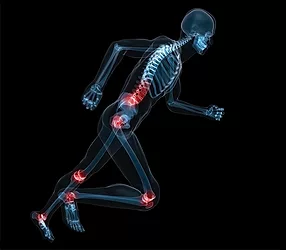 Bonejoint 1