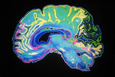Brain1