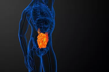 Crohns 1