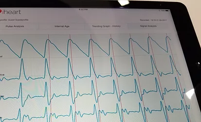 Iheart