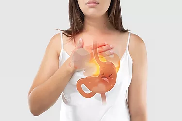 Acid reflux